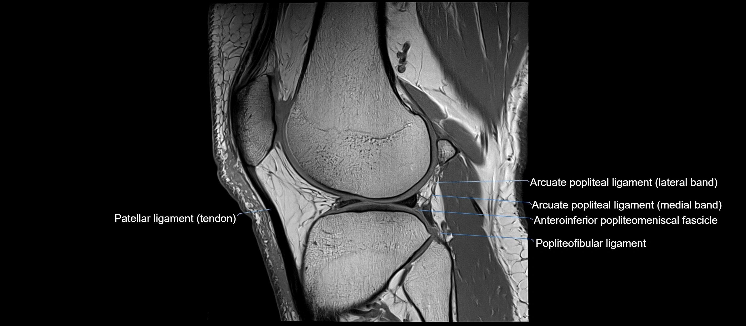 MRI sagittal  ligaments cross sectional anatomy 3T  radiology  image-img-00001-00034.webp